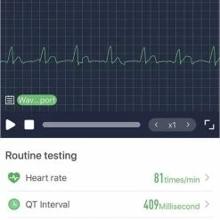 Top 10 🤩 Belesy® Tachy - Smartwatch Heren - Smartwatch Dames - Horloge - Stappenteller - Hart ECG - 1.3 Inch - Kleurenscherm - Donker Bruin - Leer 💯 -Sieraden-horloges Winkel 515x840